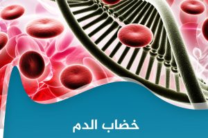 شو بتعرف عن خضاب الدم؟